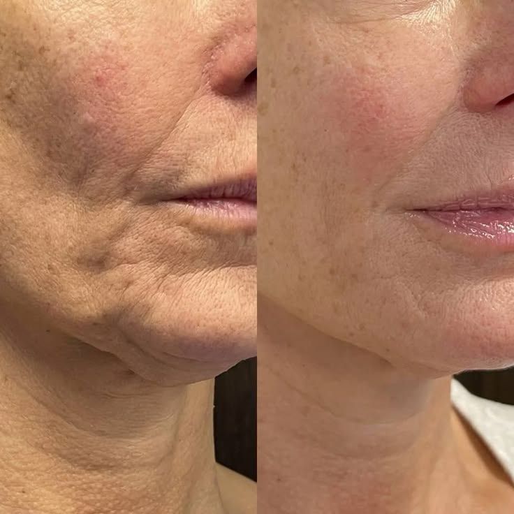 Anti-Aging Facial